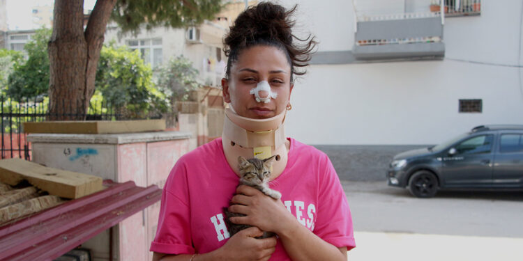 Pitbull köpek, kedilerine saldırdı, sahibi burnunu kırdı