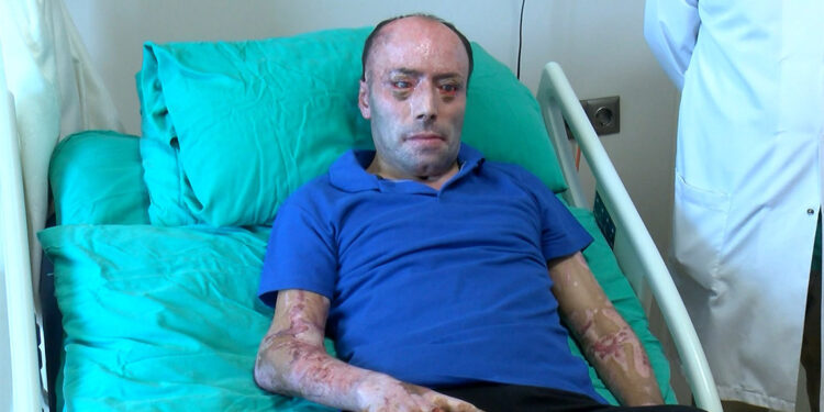 İzzet Ak'ın tedavisi bayram dönüşü devam edecek