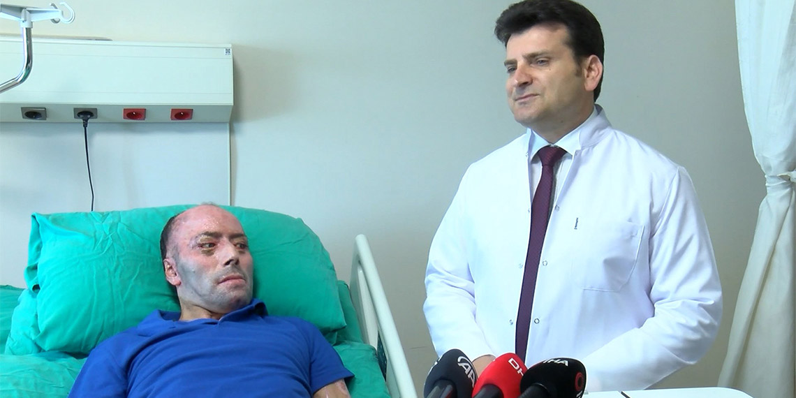 İzzet Ak'ın tedavisi bayram dönüşü devam edecek