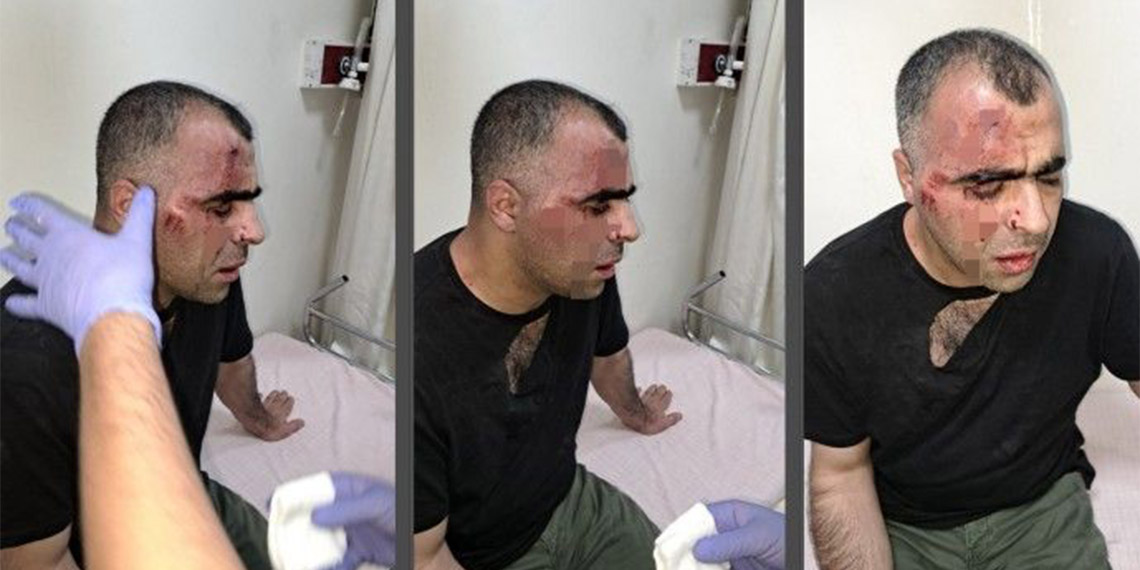 Sinan Aygül'ün darbedilimesinde yeni gelişme