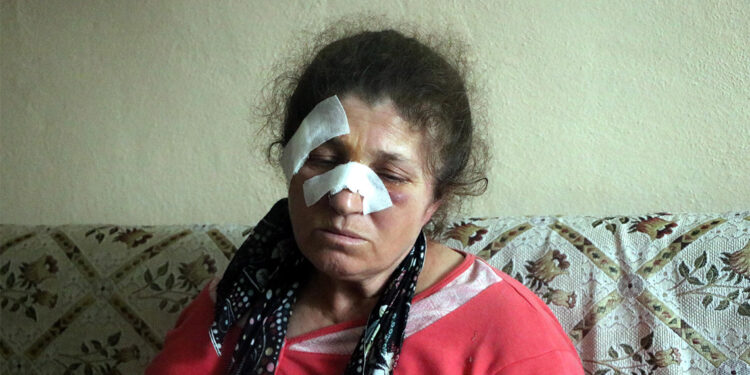 Husumetli akrabalarının baltalı saldırısına uğradı