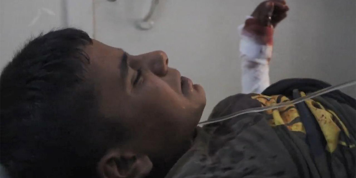 Rus savaş uçaklarınca dün İdlib'e düzenlenen saldırıda yaralı sayısı 61’e yükseldi. Beyaz Baretliler tarafından paylaşılan görüntülerde, hastaneye kaldırılan çocukların ağladığı anlar da yer aldı.