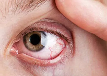 Erken tedavi edilmeyen retina hastalıkları körlük nedeni
