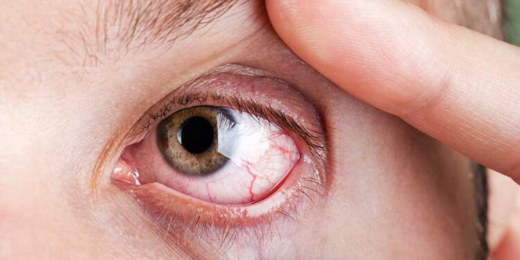 Erken tedavi edilmeyen retina hastalıkları körlük nedeni