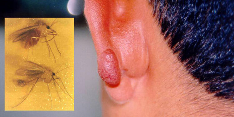 Kan emen kum sineğine kalıcı hasarlara neden oluyor