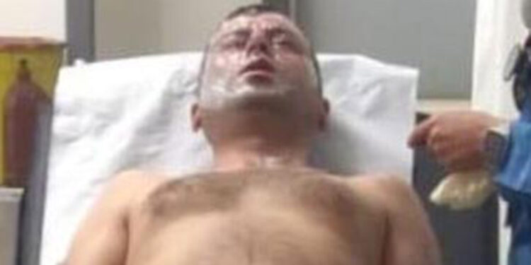 Lavabo açıcının patlamasıyla yaralandı