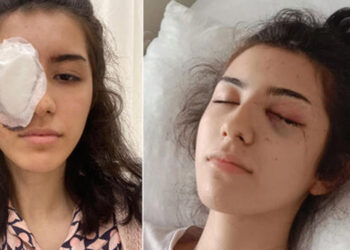 Maganda kurşunu 16 yaşındaki Havin'i kör etti