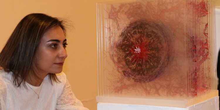 Migren ataklarını sanata yansıttı