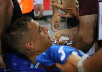 Trabzonspor'da Benkovic'in burnunun kırıldığı açıklandı