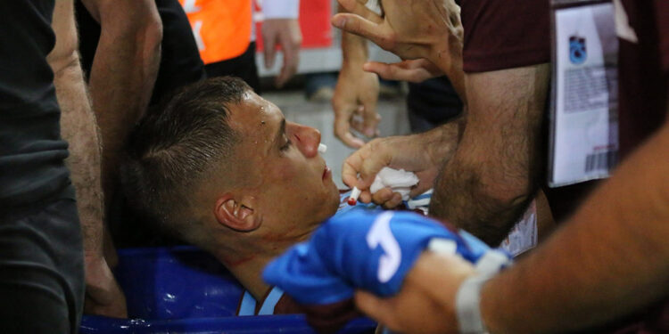 Trabzonspor'da Benkovic'in burnunun kırıldığı açıklandı
