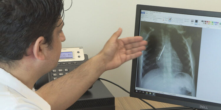 Uzmanı uyardı; Disk pilleri çocuklardan uzak tutun