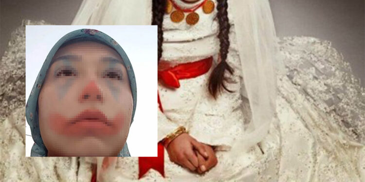 15 yaşındaki kızın evlendirileceği damat adayı ve ailesi gözaltında