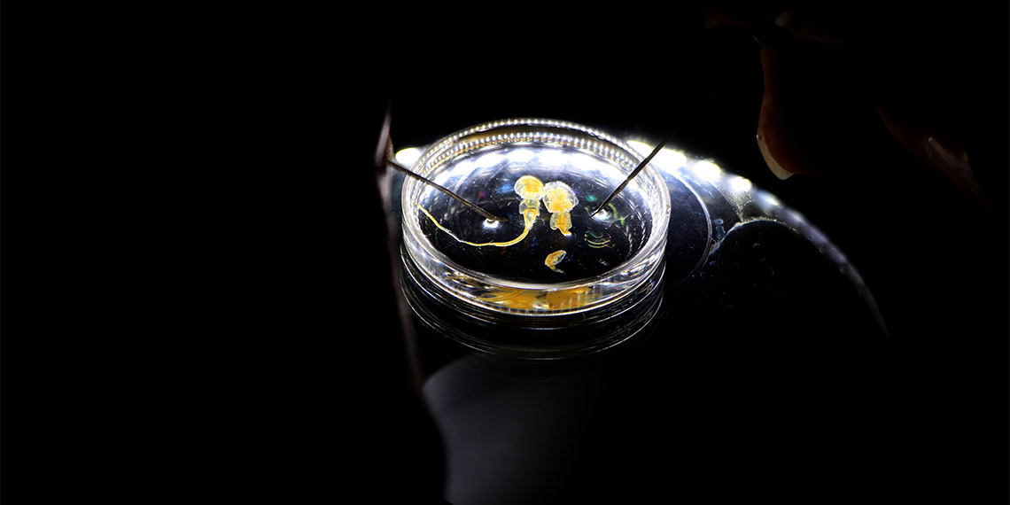 Çukurova Üniversitesi Su Ürünleri Fakültesi Balık Hastalıkları Ana Bilim Dalı Üyesi Doç. Dr. Argun Akif Özak, Türkiye'deki marketlerde satılan Norveç somonunda parazite rastladığını açıkladı.