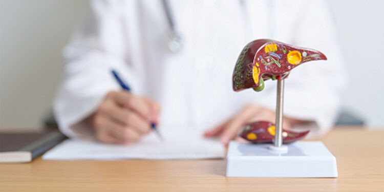 Sirozun tedavisi kişiye özeldir