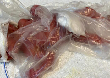 650 gram doğan Zehra, mücadelesinden zaferle çıktı