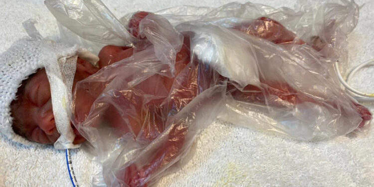 650 gram doğan Zehra, mücadelesinden zaferle çıktı