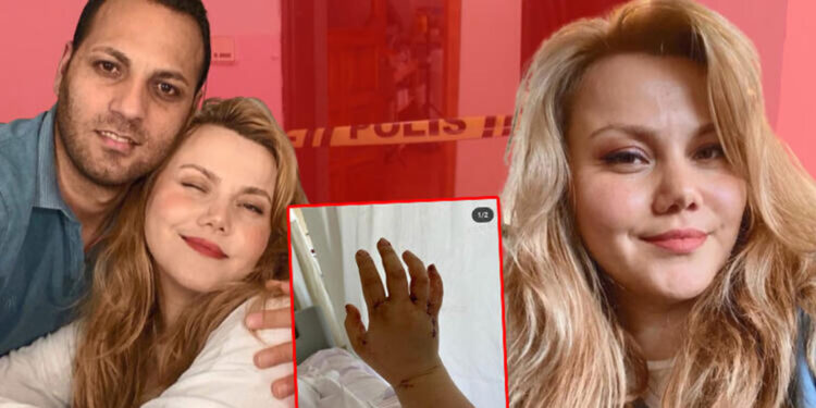 Eşi tarafından bıçaklanan youtuberdan ilk paylaşım