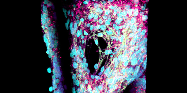 Minyatür organ üretimi ile Parkinson'a kalıcı çözüm arıyorlar