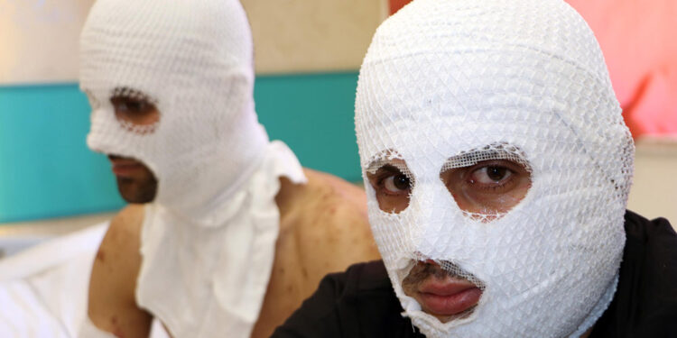 Otomobilde çakmak gazı tüpü patladı; 2 yaralı