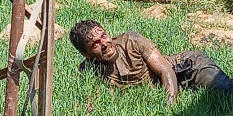 Şanlıurfa'da tedavi gören kuduz hastası öldü