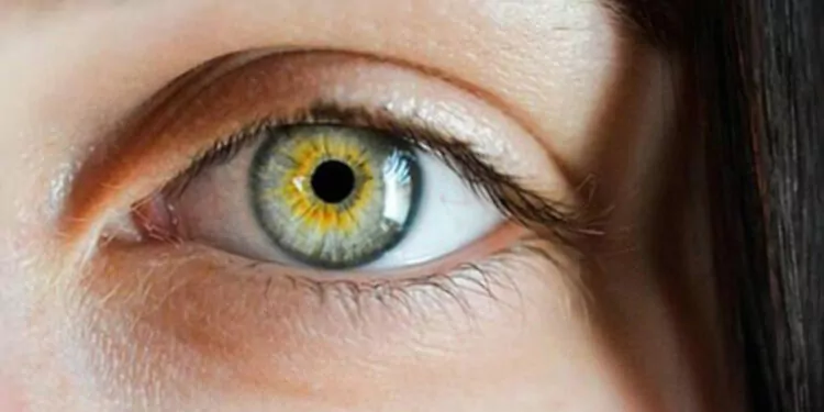 Sarı nokta hastalığı görme kaybına neden olabilir