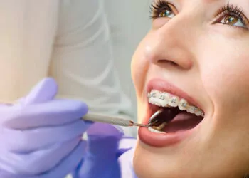 Ağız ve diş sağlığı sorunları öz güven problemine yol açabilir