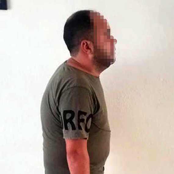 Bel romatizması erkeklerde 3 kat fazla görülüyor