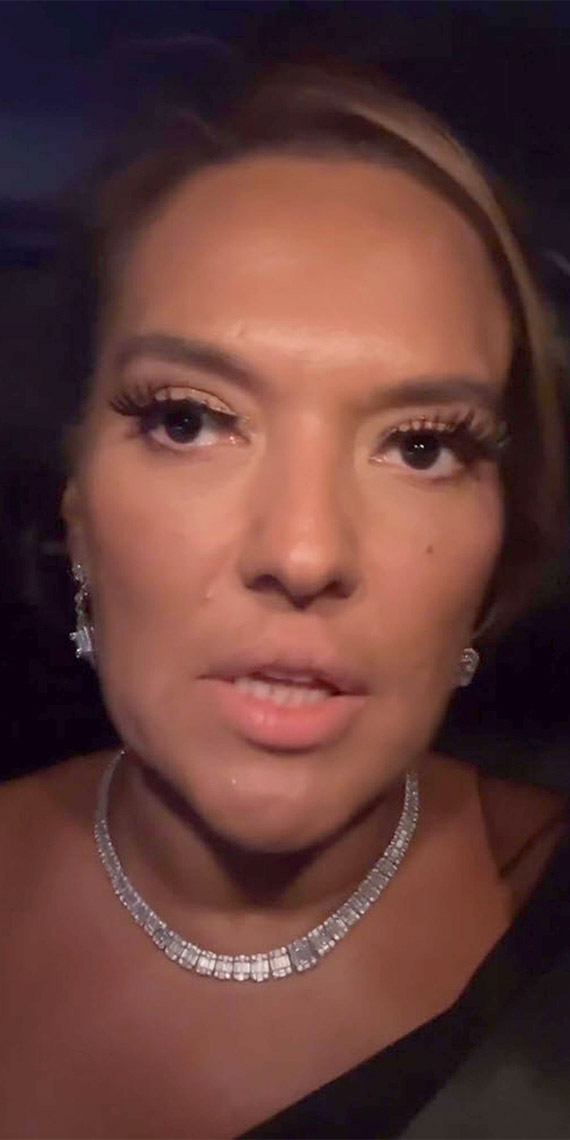 Demet Akalın tekne kazası geçirdi