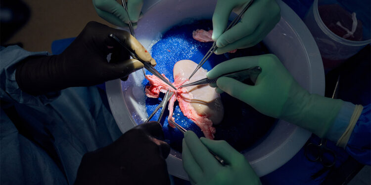 Domuz böbreği insan vücudunda işlevini yerine getirdi