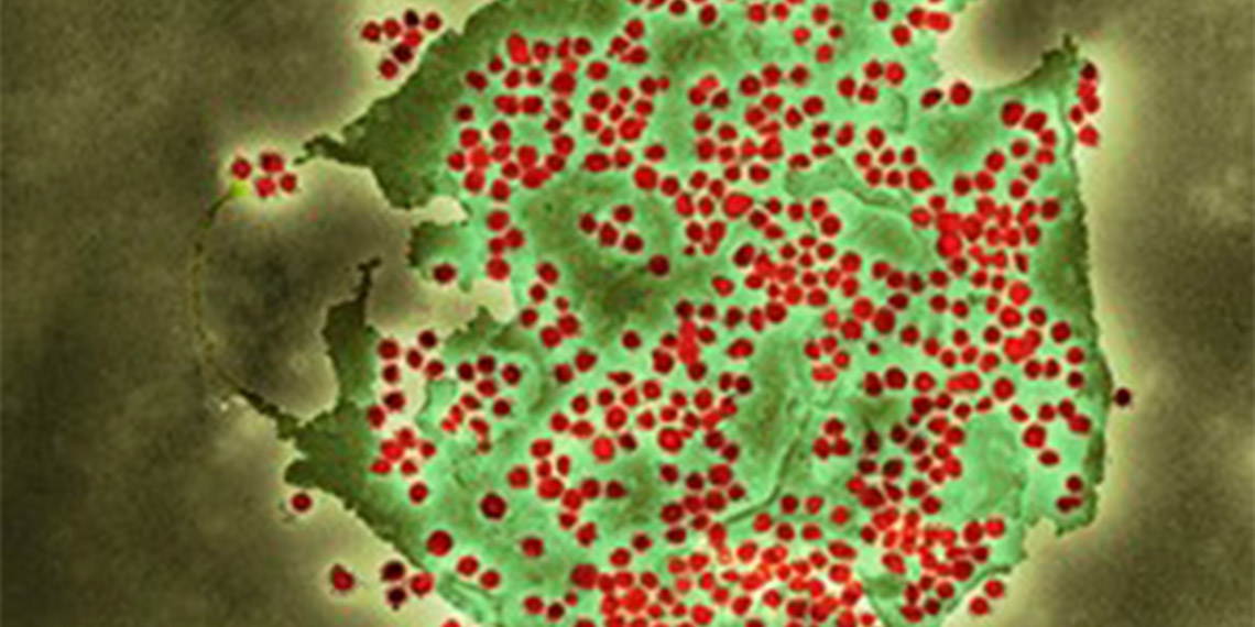 İngiltere'de kovid varyantı BA 2.86 tespit edildi