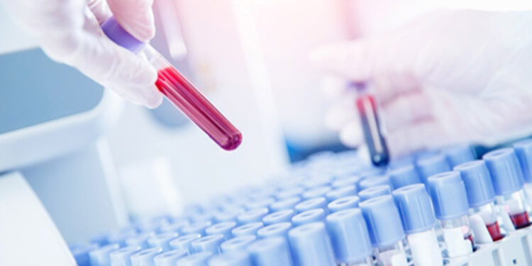 1,8 milyon kişi evlilik öncesi SMA taramasından geçti