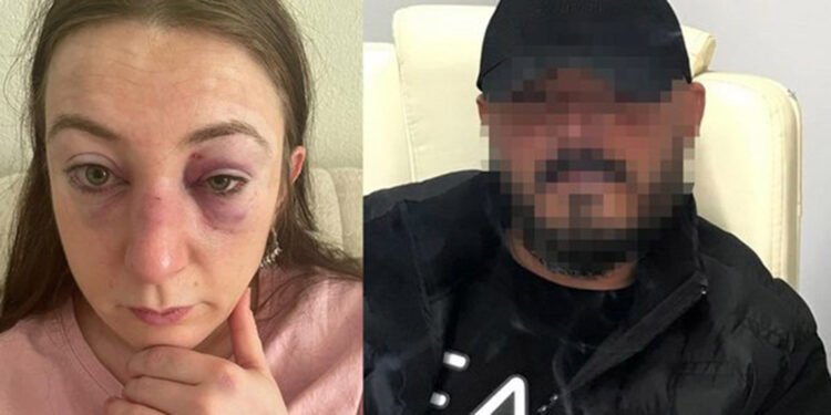 Darp edilen Sibel Kahraman'ın eski sevgilisi yakalandı