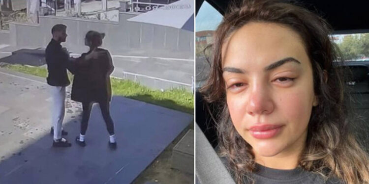 Ece Ronay'dan yardım çağrısı; şiddet görüntülerini paylaştı