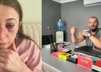 Eski sevgilisinin darbettiği Sibel: 9 defa yüzüme kafa attı
