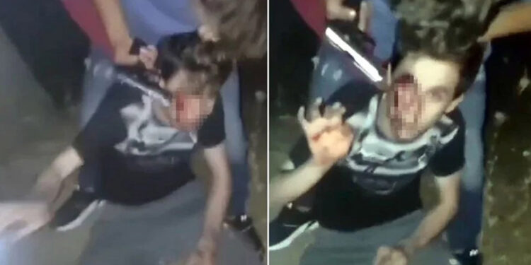 Suriyelilerin engelli genci dövdüğü olayda tutuklu sayısı arttı