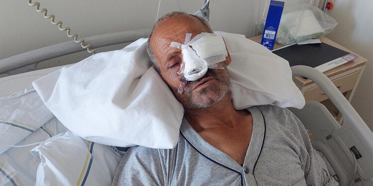 Elektrikli testere yüzünü kesti; gözünü kaybedebilir