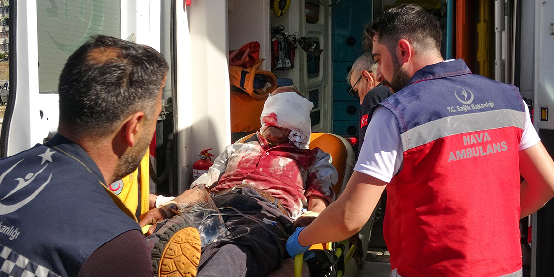 Elektrikli testere yüzünü kesti; gözünü kaybedebilir