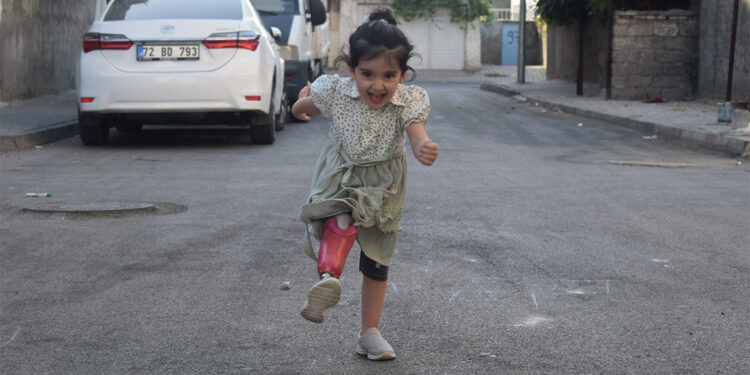 Arin ve Ayda protez bacaklarla yürümeye başladı