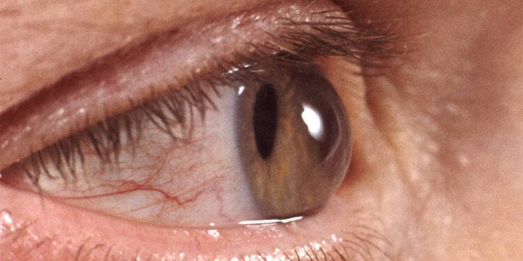 Göz sağlığını korumak için bunlara dikkat edin