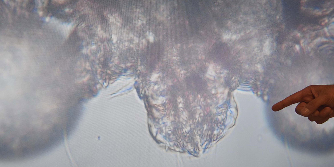 Muğla Eğitim ve Araştırma Hastanesi Dermatoloji Kliniği'nde görev yapan Doç. Dr. Aslan Yürekli, uyuz hastalığı hakkında bilgi verdi.