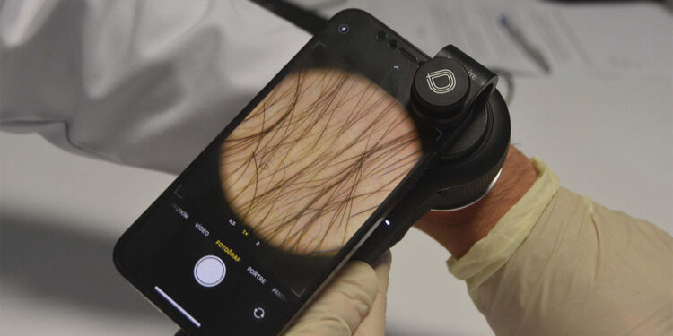 Uyuz hastalığında artış var