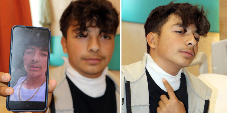 Üzerlerine yıldırım düşen Mustafa Can boynundan yaralandı