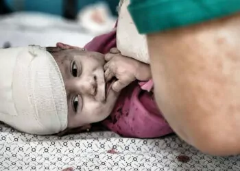 Gazze'de yaralanan çocuklar objektiflere böyle yansıdı