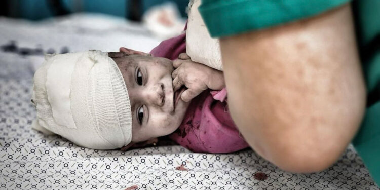 Gazze'de yaralanan çocuklar objektiflere böyle yansıdı