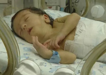 İnce bağırsağı tıkalı dünyaya gelen bebek sağlığına kavuştu