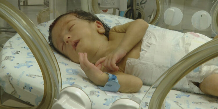 İnce bağırsağı tıkalı dünyaya gelen bebek sağlığına kavuştu