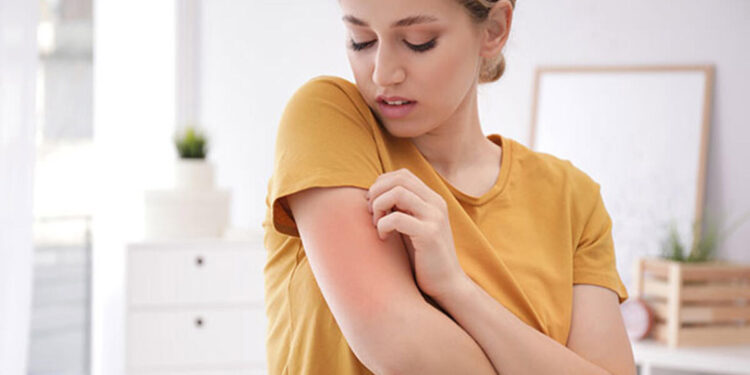 Mağazada denenen kıyafetlerden uyuz bulaşma riski var