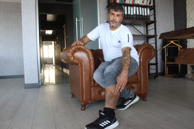 Bacağında bez parçaları unutulduğunu öğrenince şoke oldu