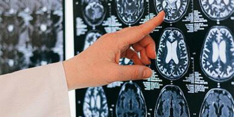 Serebral palsili çocuklar tatmin edici bir yaşam sürebilir