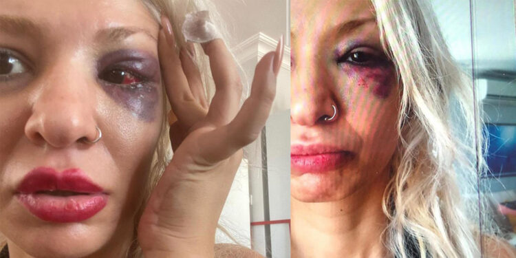 Yüzyüzeyken Konuşuruz'un gitaristine darp soruşturması